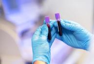 Novas diretrizes mudam alerta para falta de ferro antes da anemia nos EUA