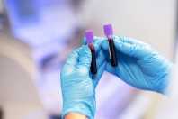 Cientistas criam, pela primeira vez, células semelhantes às do sangue de cães em laboratório