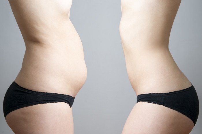Gordura abdominal: o que fazer para perder barriga de forma saudável