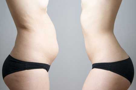 Como perder a gordura abdominal