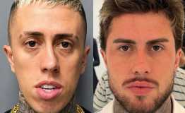 Antes e depois de MC Daniel impressiona