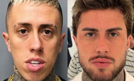 Antes e depois de MC Daniel impressiona