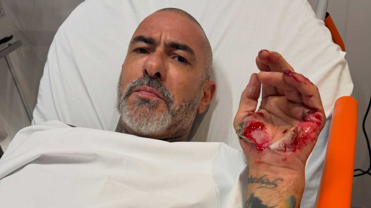 Ex-participantes do MasterChef Brasil substituem Fogaça após acidente