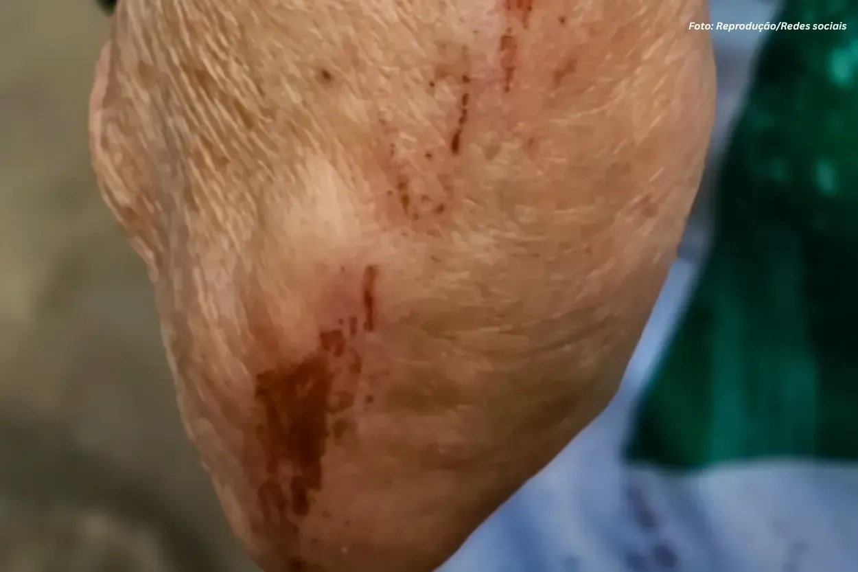 Prefeitura diz que uso de spray de pimenta em confusão após final do Distrital será apurado