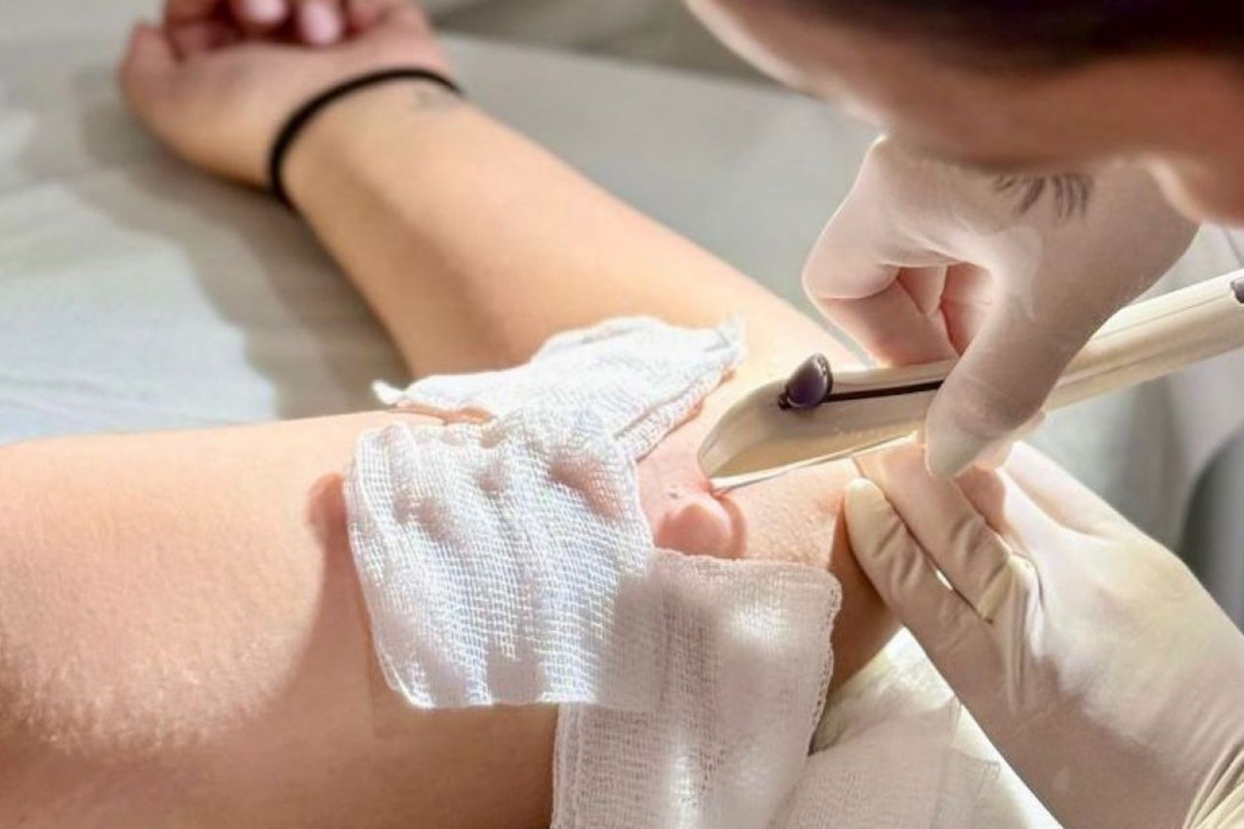 Timóteo amplia oferta de contraceptivos pelo SUS