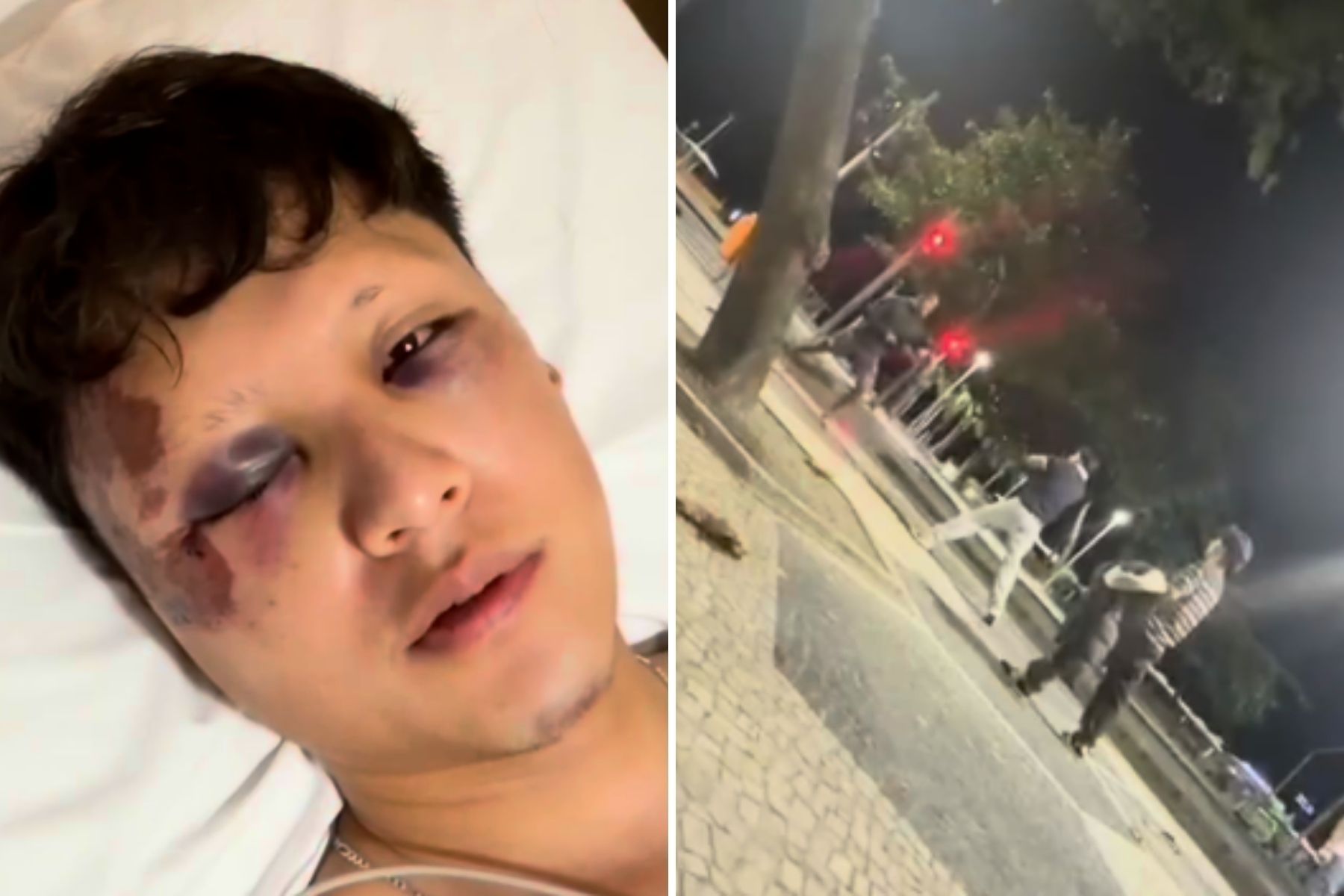 Mexicano agredido com garrafada no Rio dá forte relato e agradece atendimento: 'Tamo junto'