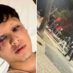 Mexicano agredido com garrafada no Rio dá forte relato e agradece atendimento: 'Tamo junto'