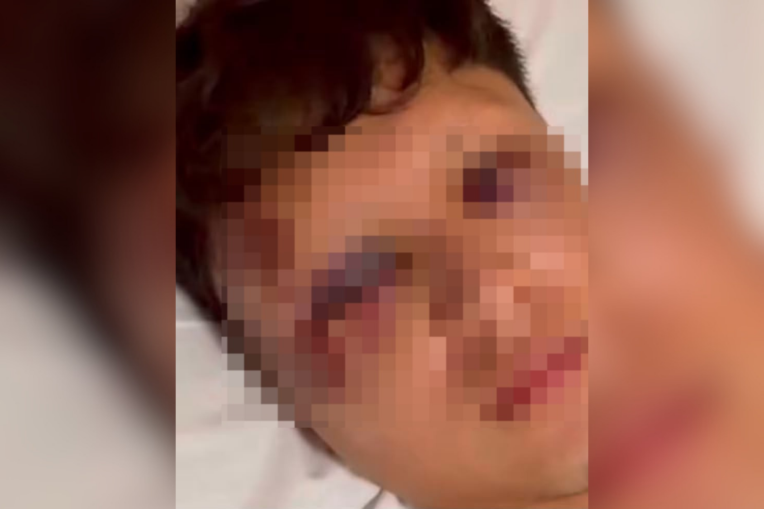 Mexicano é agredido com garrafada na cabeça e tem celular roubado em Copacabana; PC investiga