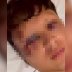 Mexicano é agredido com garrafada na cabeça e tem celular roubado em Copacabana; PC investiga