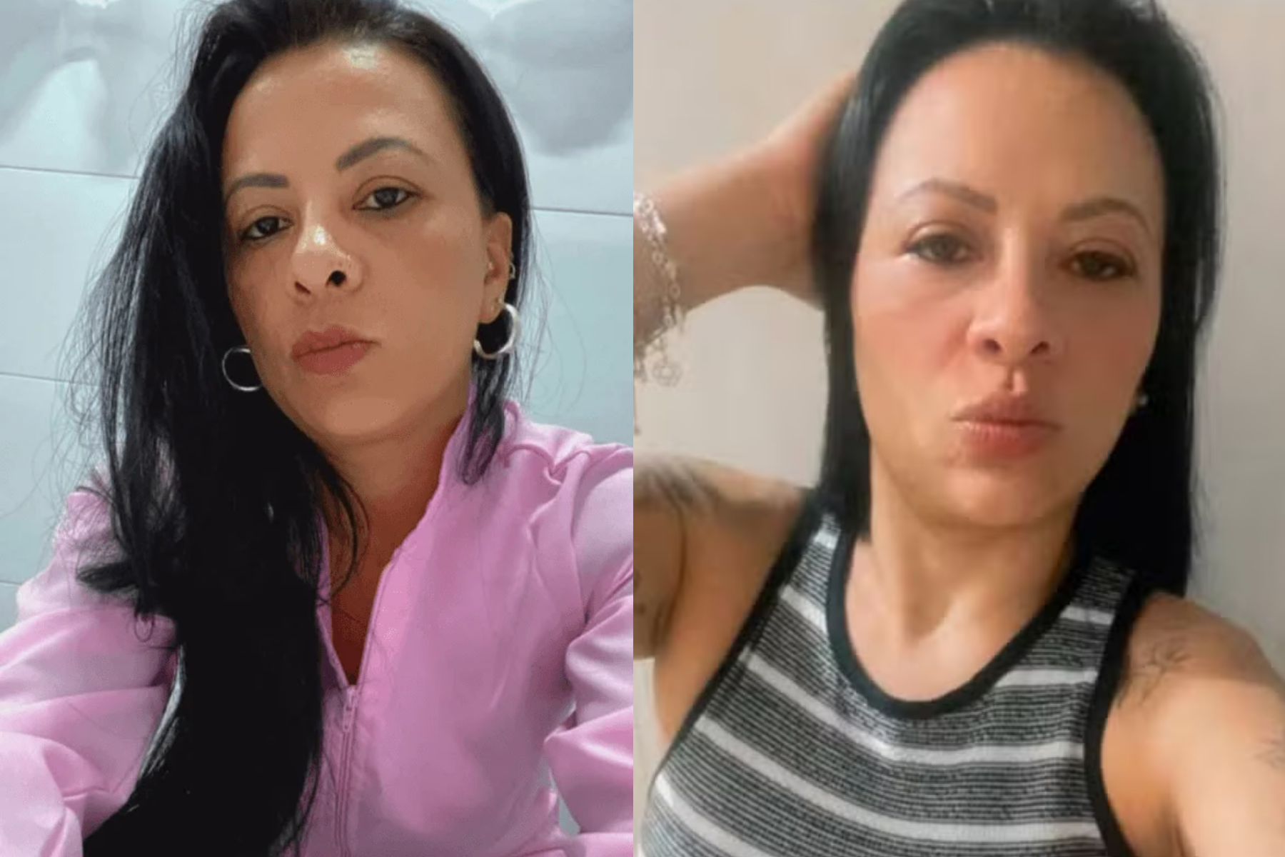 Mulher morre após ter intestino perfurado durante exame de colonoscopia em hospital de SP