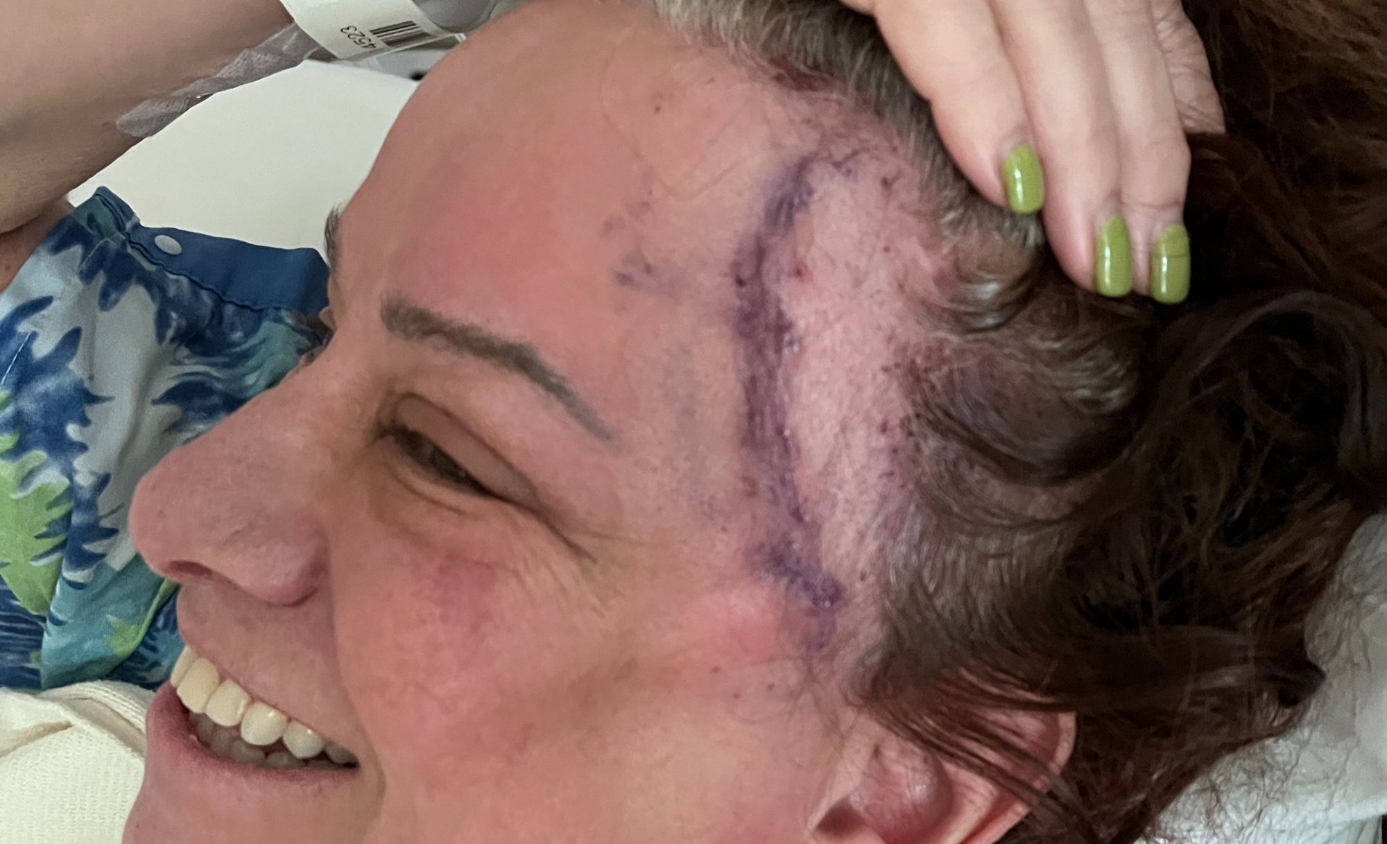 Jennifer Finch arrecada quase R$ 2 milhões para tratamento de câncer agressivo