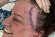 Jennifer Finch arrecada quase R$ 2 milhões para tratamento de câncer agressivo