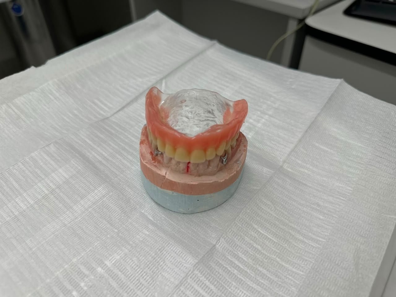 Mutirão de próteses dentárias começa em Timóteo