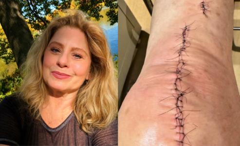 Vera Fischer passou por cirurgia há dois meses