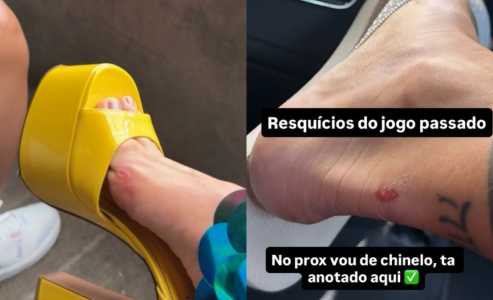 Virginia exibe pés machucados • Reprodução | Redes sociais