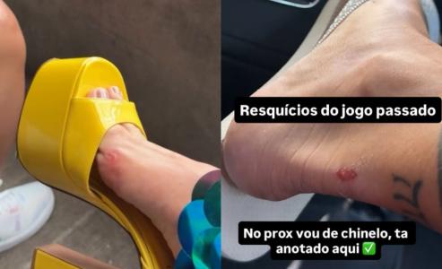 Virginia exibe pés machucados • Reprodução | Redes sociais