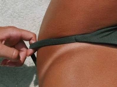Marquinha de biquíni 'natural': dermatologista alerta para riscos da exposição solar