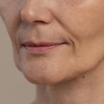 'Mounjaro face': o que é, por que acontece e como prevenir