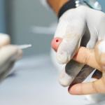 Prefeitura anuncia queda superior a 95% em casos de hepatite A em Juiz de Fora