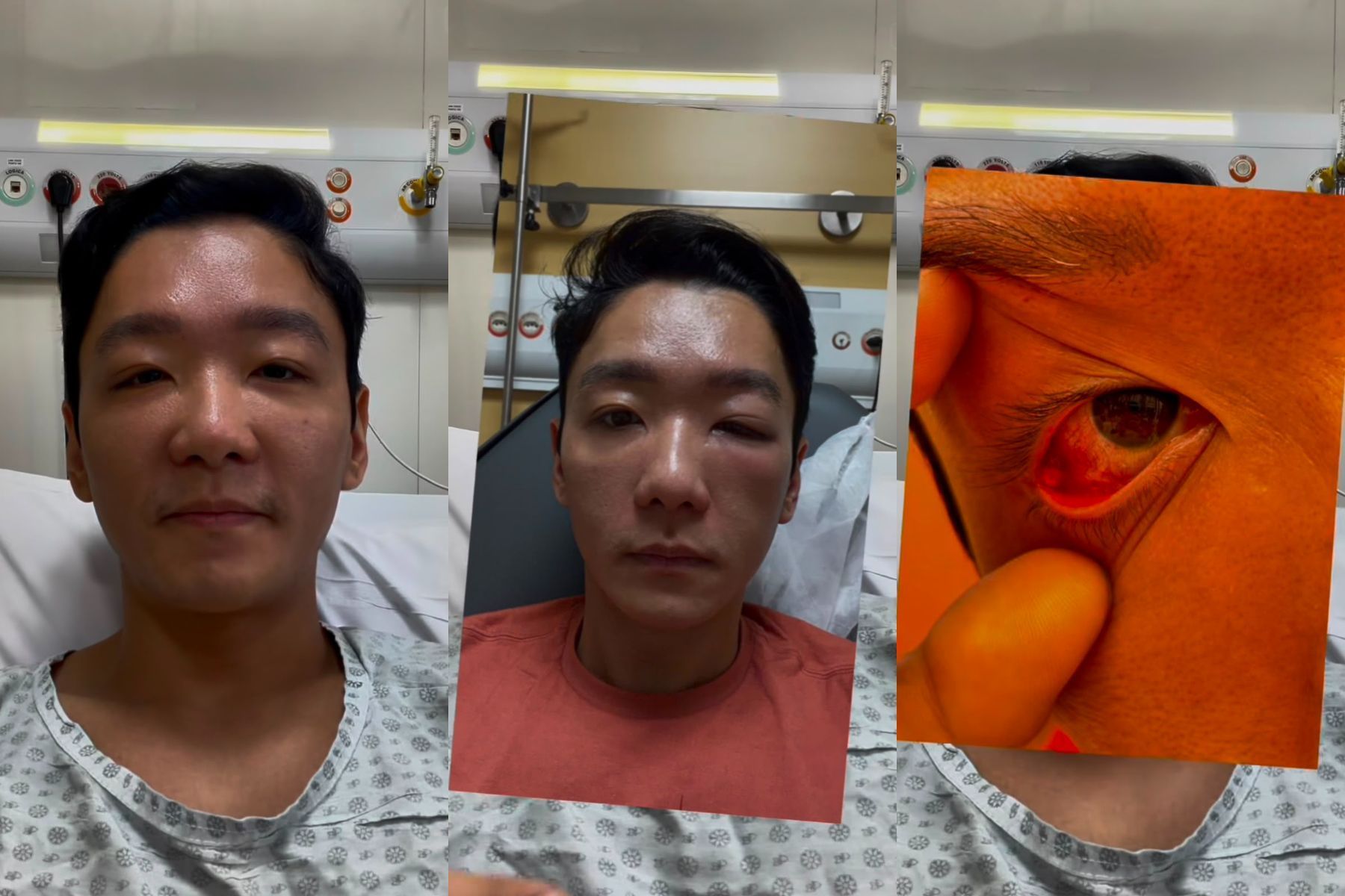Campeão do MasterChef, Cesar Yukio atualiza quadro de saúde após internação e faz alerta
