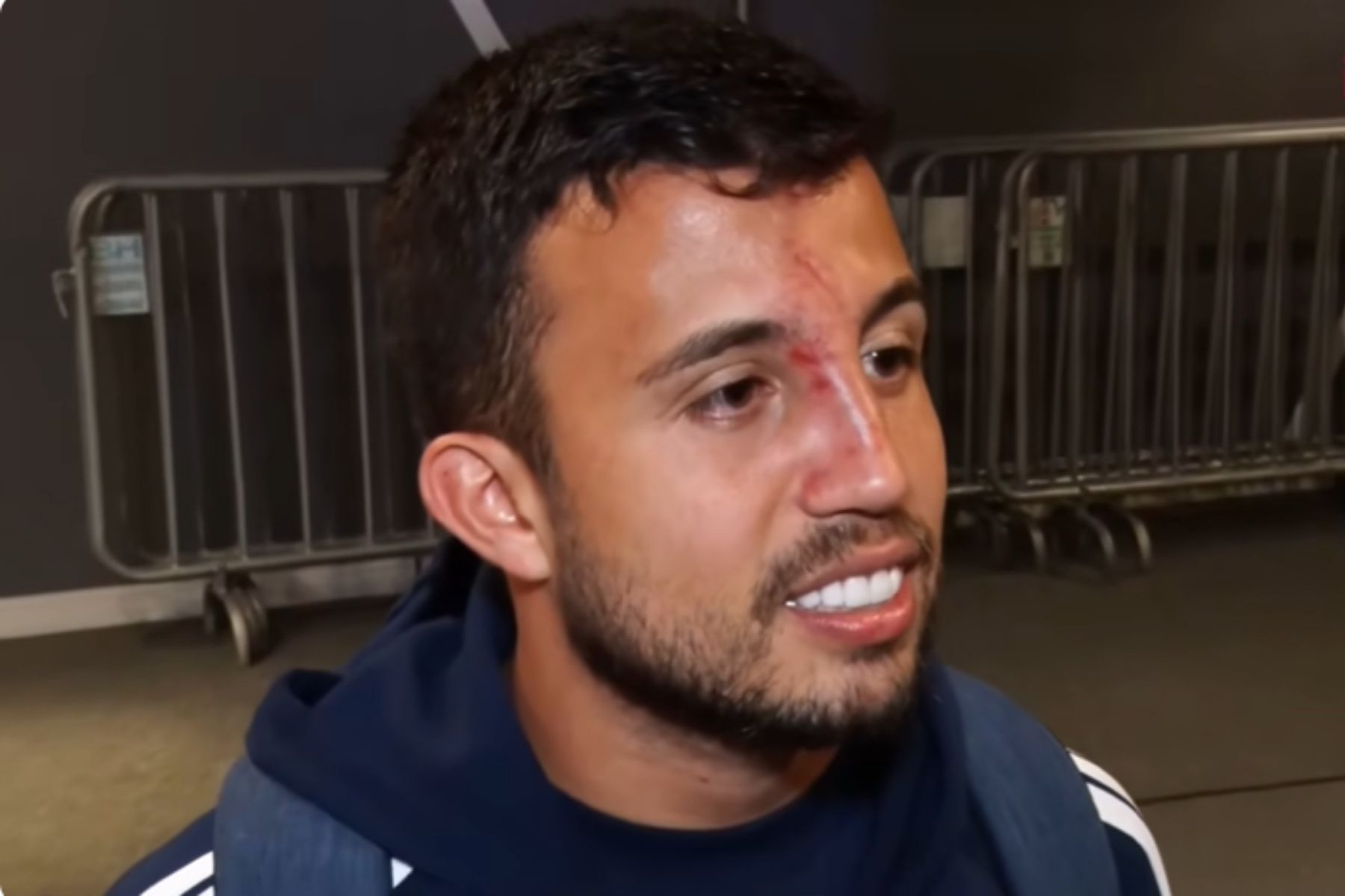 Cruzeiro: Matheus Henrique minimiza 'marcas da batalha' no nariz e na canela