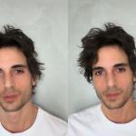 Fiuk mostra resultado de harmonização facial: 'Noites sem dormir'