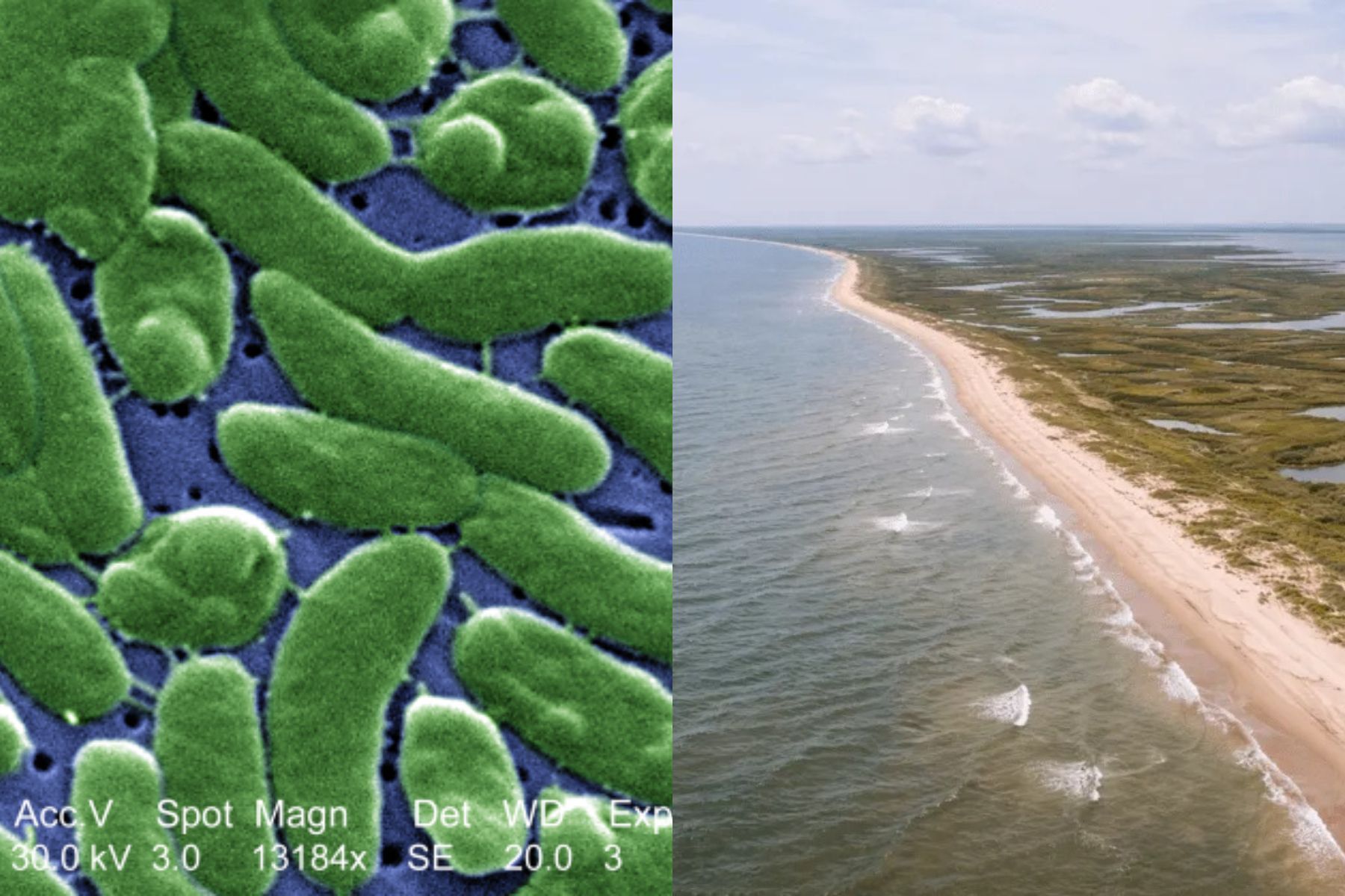 EUA: Louisiana emite alerta após praias registrarem aumento de infecções de bactéria carnívora