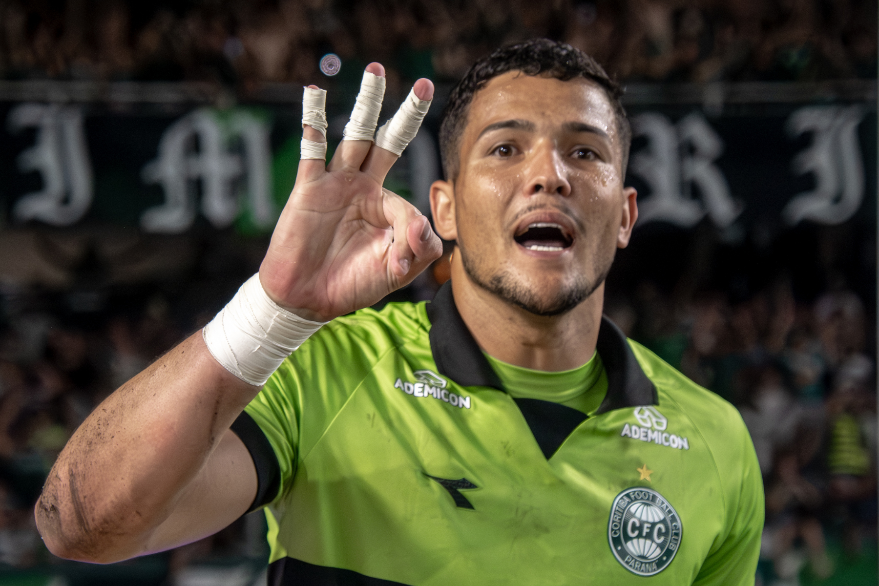 Coritiba informa lesão e cirurgia do goleiro Pedro Rangel