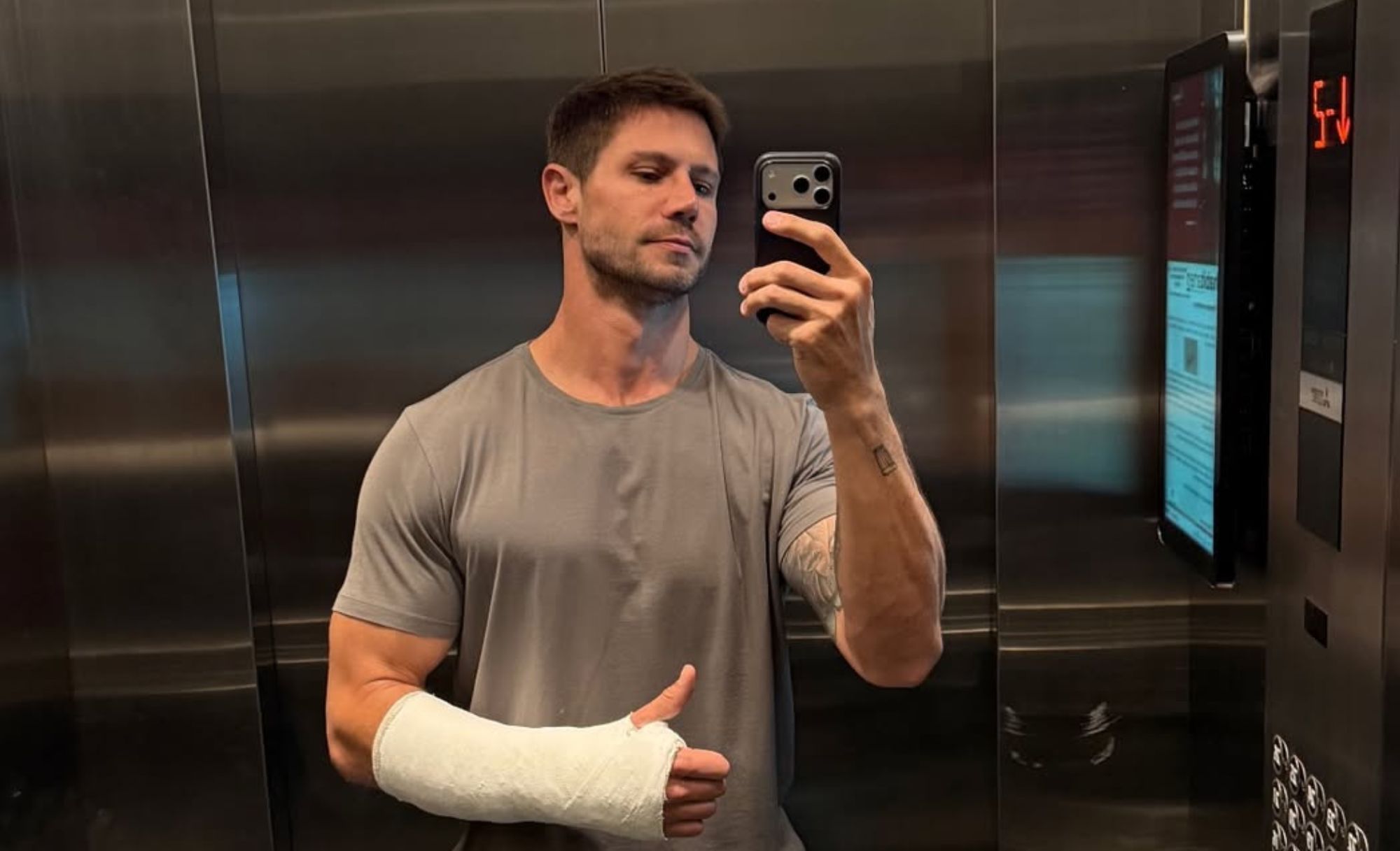 'Ficar sem uma mão é difícil', diz ex-BBB Jonas Sulzbach após acidente