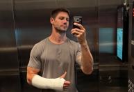 'Ficar sem uma mão é difícil', diz ex-BBB Jonas Sulzbach após acidente