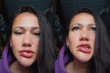 Nas fotos, Raíssa Duarte, vítima de agressão e furto no Mercado Novo, em Belo Horizonte • Imagens cedidas à Itaitiaia