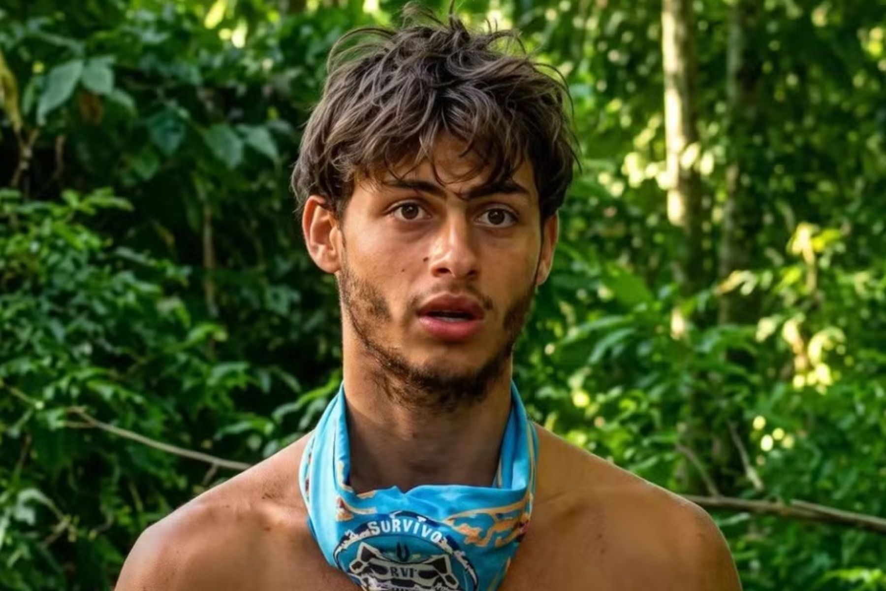 Ex-participante de reality processa produção após perder a perna em acidente
