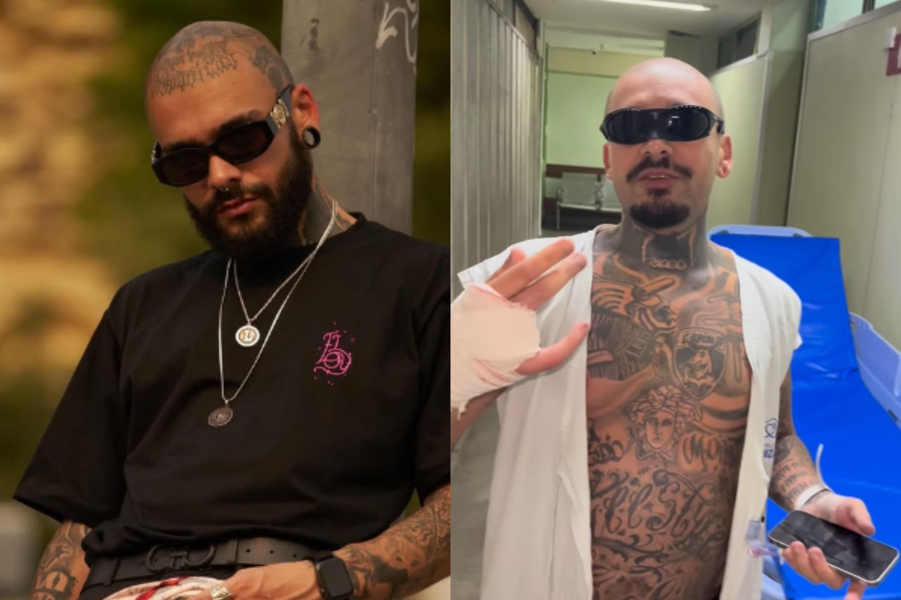 Quem é Lodk, influenciador que teve dedo amputado no Rock in Rio