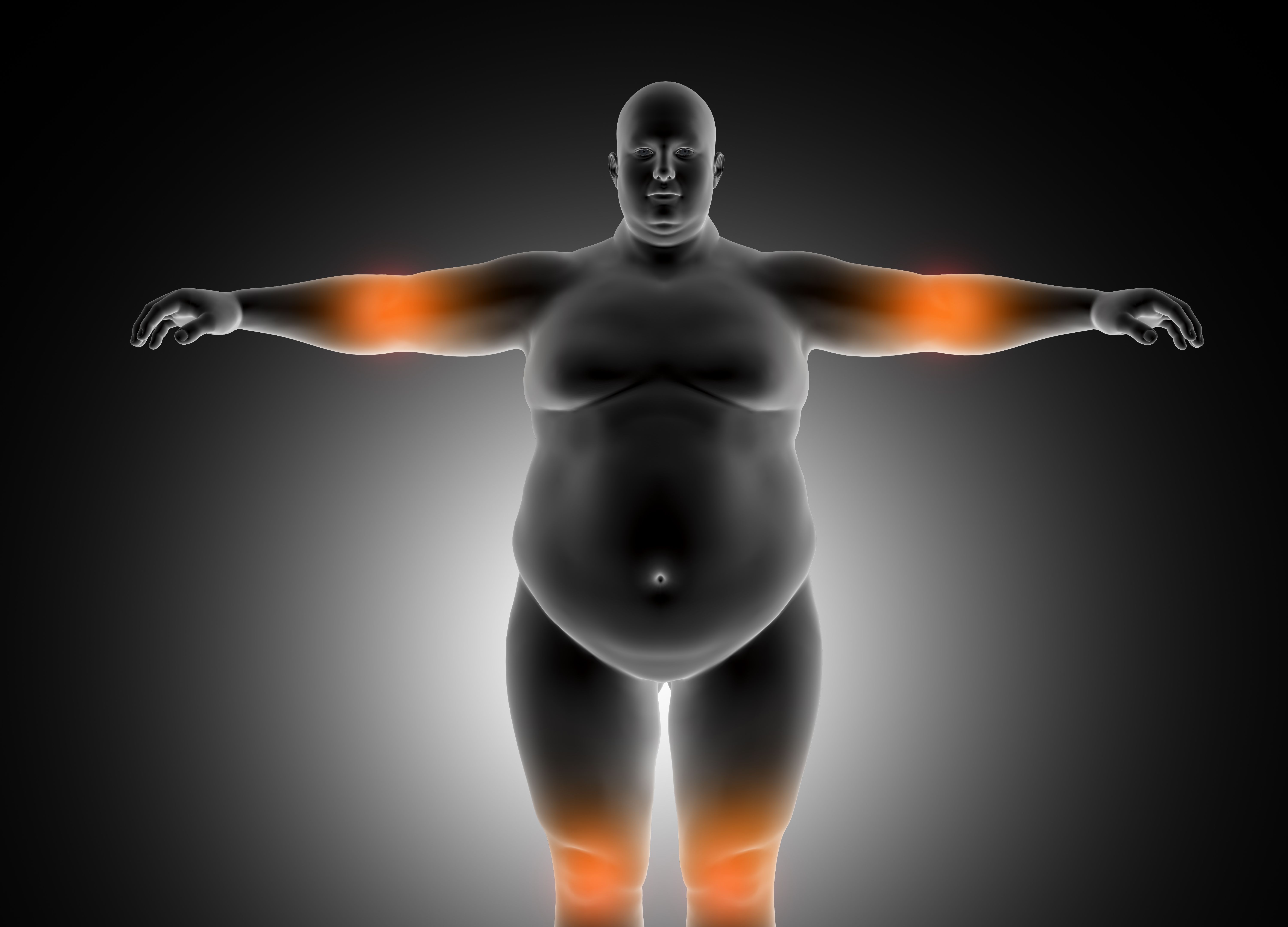 Gordura invisível: 5 estratégias para reduzir o acúmulo que aumenta riscos à saúde
