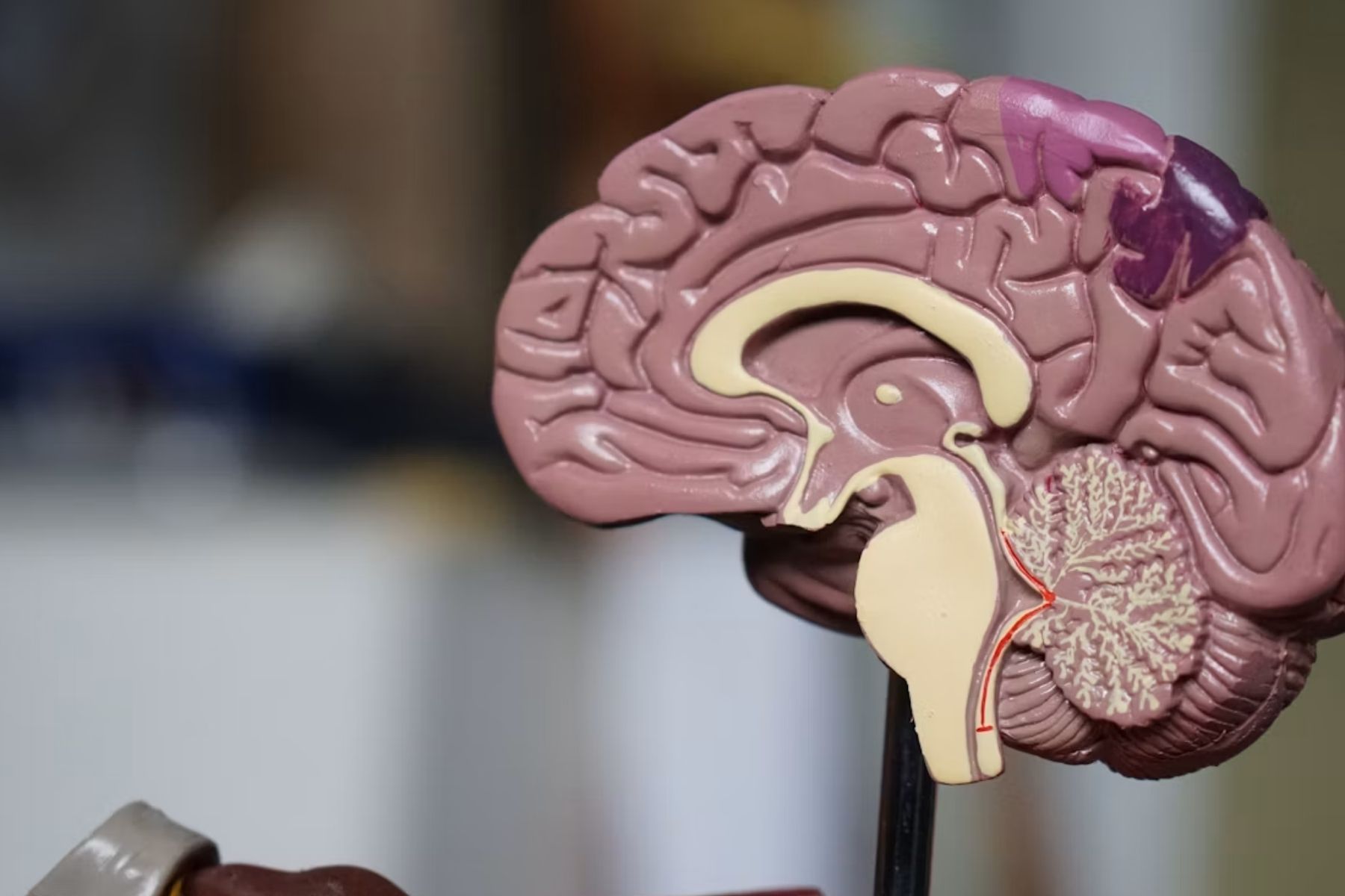 Novo teste pode identificar tipo de tumor cerebral mais rápido; entenda