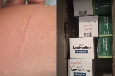 Menina de 4 anos inicia tratamento contra HIV após ser ferida por colega em escola de MG
