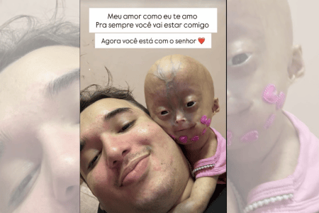 • Reprodução