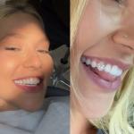 Sorriso de milhões: Virginia coloca diamantes nos dentes e exibe resultado