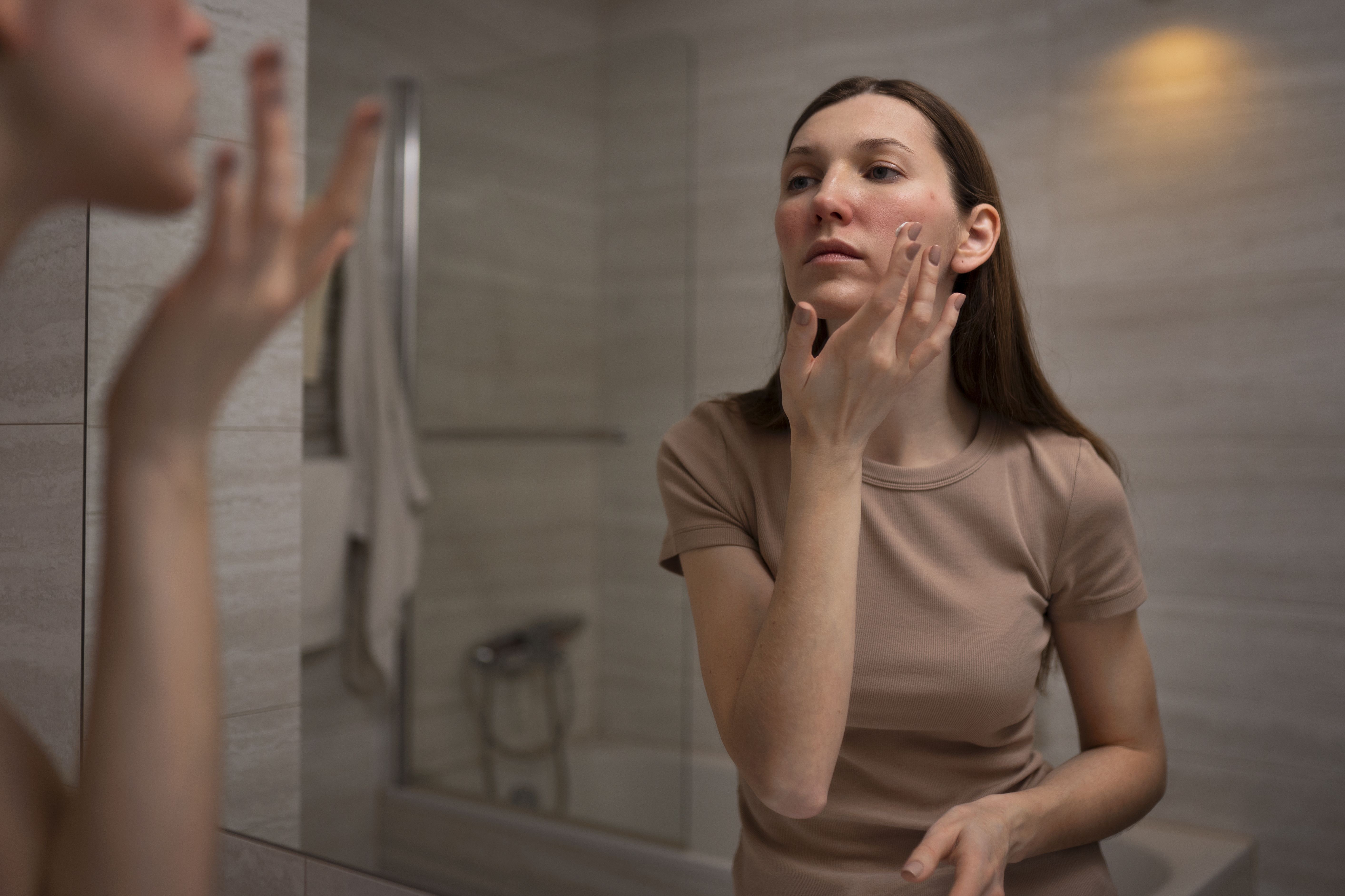 Acne adulta pode surgir depois dos 30 e ter relação com hormônios e estresse