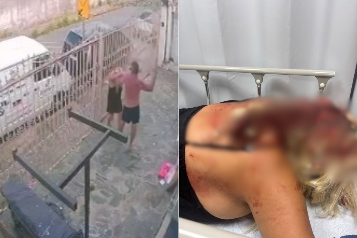 ‘Tenho certeza que ele vai me matar se for solto’, diz mulher agredida com barra de ferro pelo marido em BH