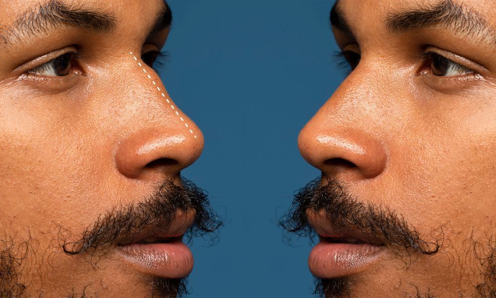 Respiramos de forma igual pelas duas narinas? A resposta pode te surpreender