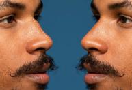 Respiramos de forma igual pelas duas narinas? A resposta pode te surpreender