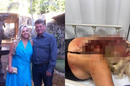 Polícia pede medida protetiva para mulher agredida com barra de ferro pelo marido em BH