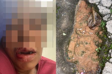 Homem é suspeito de arrancar os dentes da ex-namorada com alicate em MG