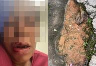 Homem é suspeito de arrancar os dentes da ex-namorada com alicate em MG