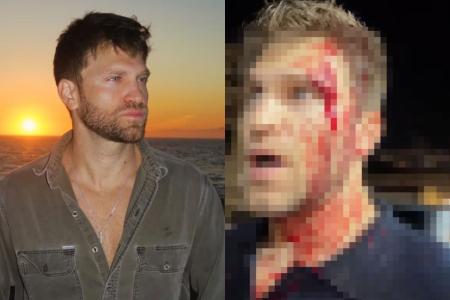 Keegan Allen apareceu ensaguentado nas redes sociais após o assalto
