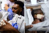 Vídeo: pais fazem contato pele a pele com bebê prematuro usando técnica inovadora