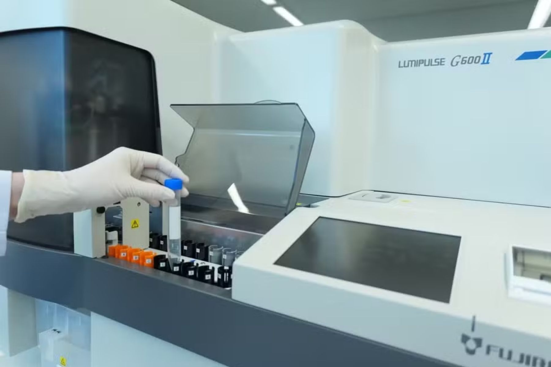 Exame de sangue para Alzheimer chega ao Brasil; veja preço e quem pode fazer