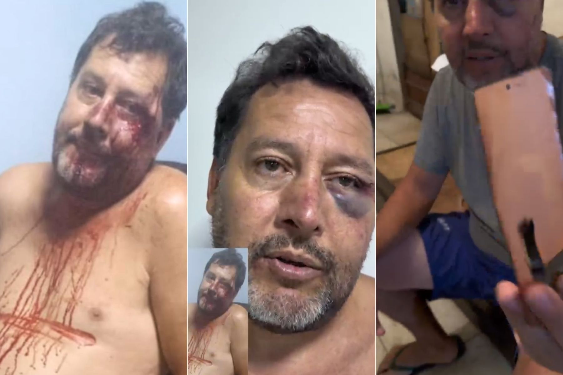 Assessor parlamentar denuncia sessão de espancamento durante ação da PM em Sabará