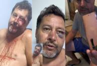 Assessor parlamentar denuncia sessão de espancamento durante ação da PM em Sabará